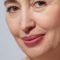 FILLER PIEGHE con acido ialuronico