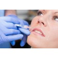 FILLER RUGHE a base di acido ialuronico 1T (trattamento)