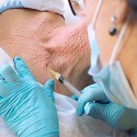 BIOSTIMOLAZIONE COLLO E VISO  
