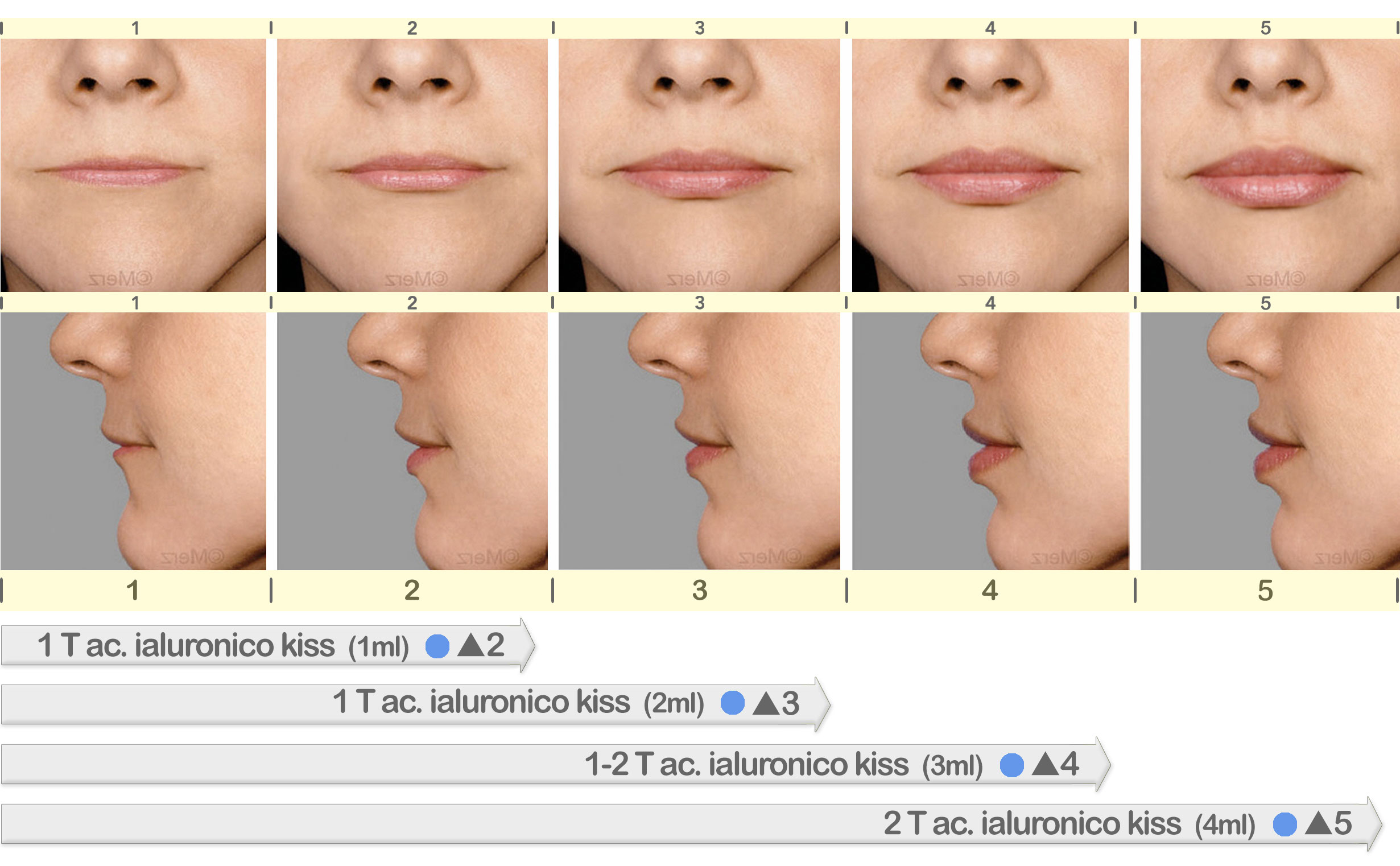 Guida-VIKISS.jpg